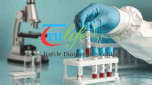 Blood-Test-In-Narsingi-Hyderabad-Trulife-Diagnostic-1