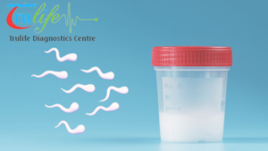 Expert-Semen-Analysis-Services-in-Hyderabad-Trulife-Diagnostics-7