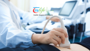 Feature-img-Trulife-4