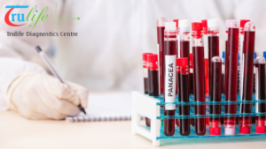 Seamless-Convenience-with-Trulife-Diagnostic-Easy-Access-to-Blood-Testing-and-Diagnostic-Services-in-Hyderabad-5