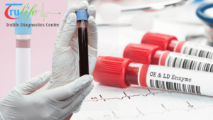 Blood-Test