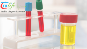Blood-Tests-in-Suncity-Hyderabad-2