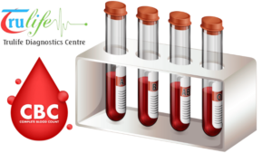 Book-Blood-Test-At-Home-Visit-Manikonda-Hyderabad-Trulife-Diagnostic-2