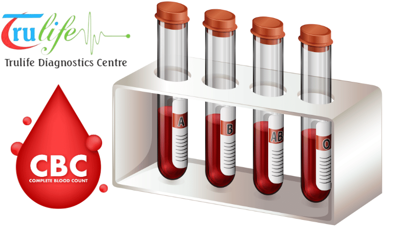 Book-Blood-Test-At-Home-Visit-Manikonda-Hyderabad-Trulife-Diagnostic-2