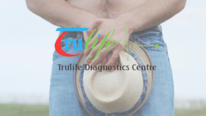 Book-Penile-Doppler-Test-In-Hyderabad-3