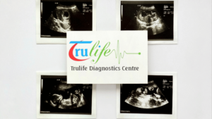 Early-Pregnancy-Scan-Test-In-Manikunda-2-2