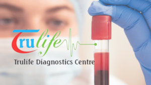 Histopathology-Blood-Test-In-Hyderabad-3