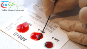 Home-Visit-Blood-Test-Near-Me-Service-Overview-by-Trulife-Diagnostics-1