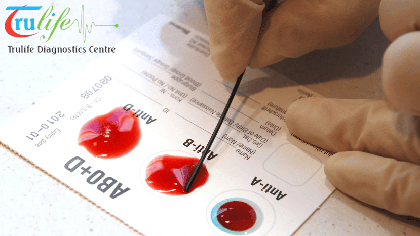 Home-Visit-Blood-Test-Near-Me-Service-Overview-by-Trulife-Diagnostics-1