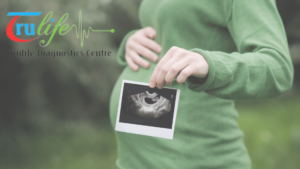 Ultrasound-scanSonography-6