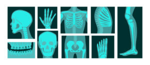 X-ray of human body parts vector illustrations set